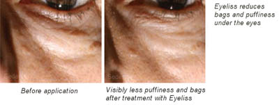 Haloxyl and Eyeliss